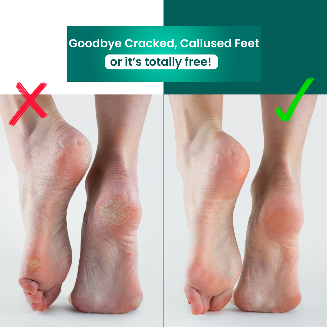 ToughFoot™ Fußschwielenentferner