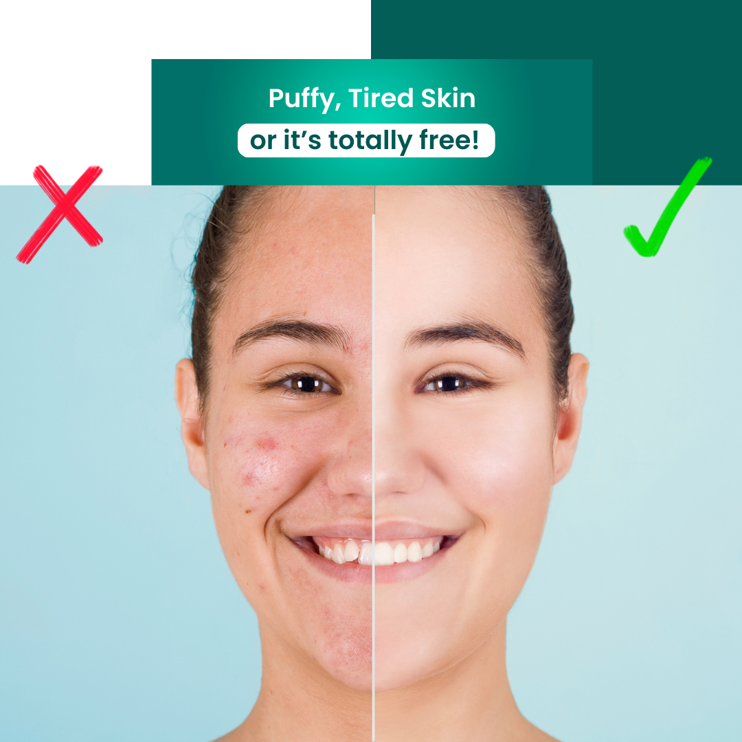 FaceZen™ Gesichtsroller