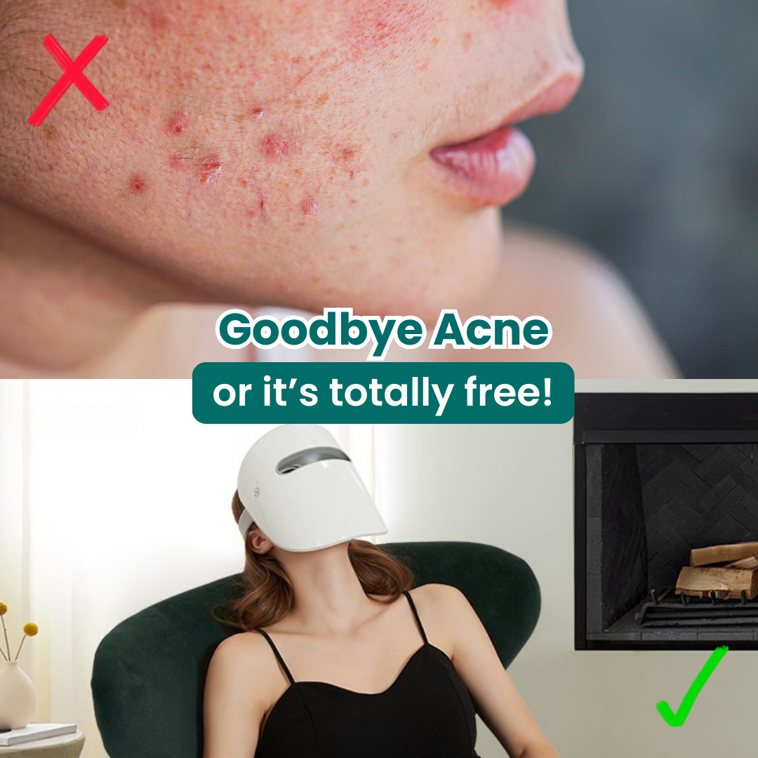 GlowVantage™ LED Face Mask