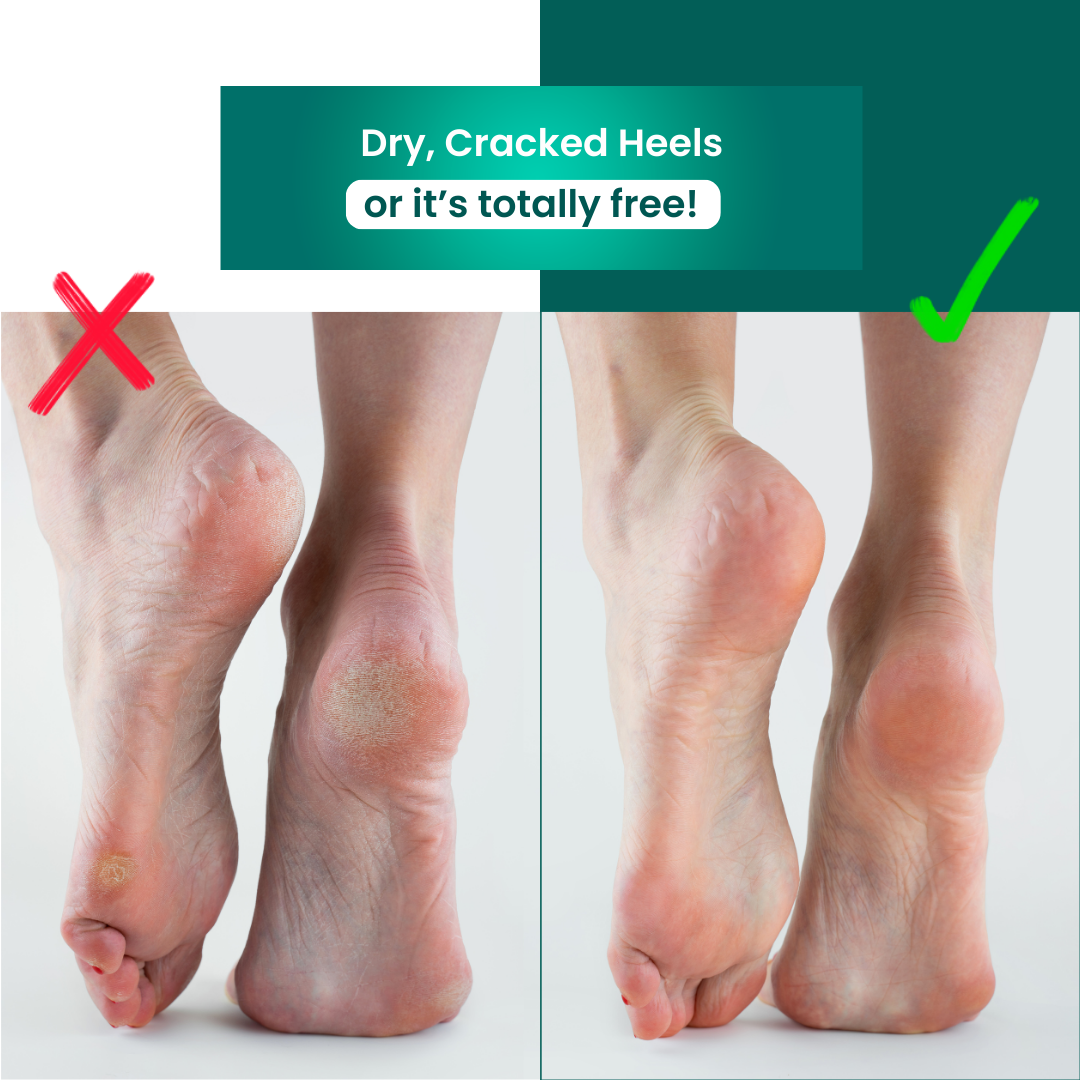 SonicPedi™ Hornhautentferner