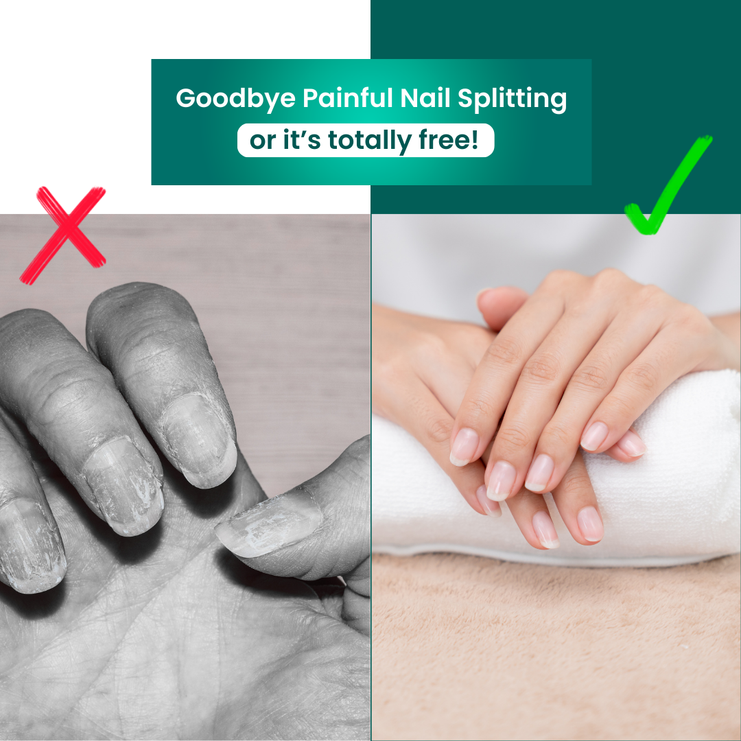 QuickTrim™ Nagelknipser