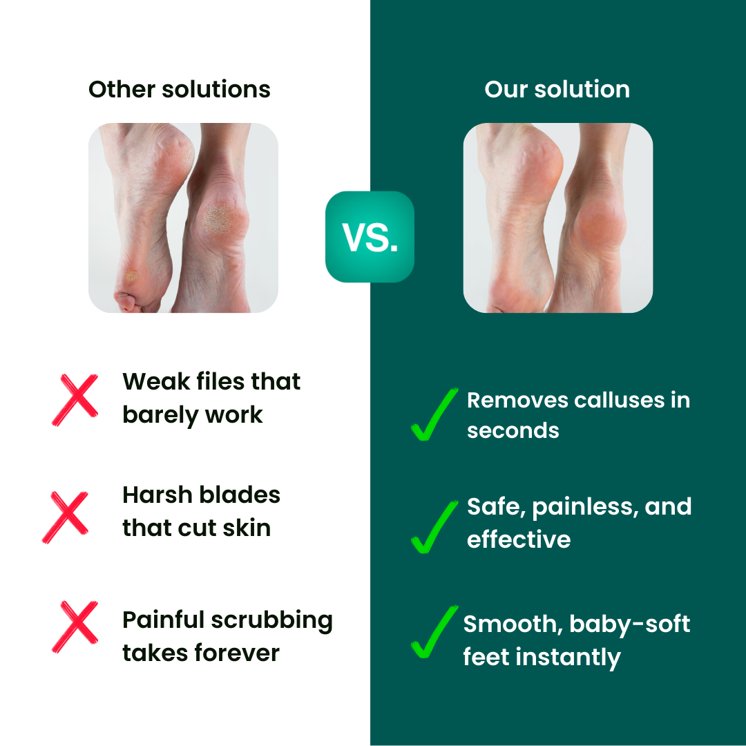 FootGlow Rasp™ Hornhautentferner