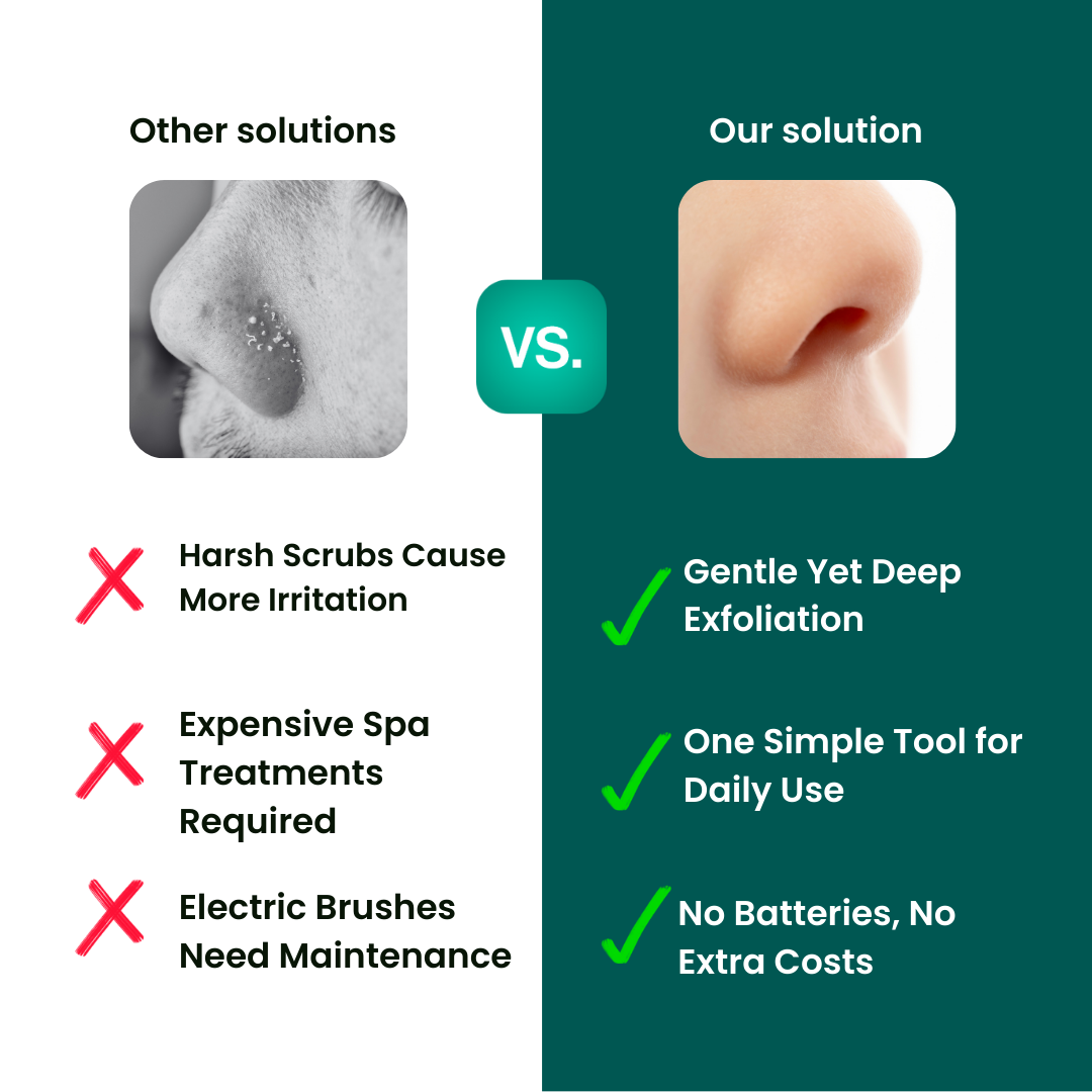 PorePrime™ Peeling-Bürste