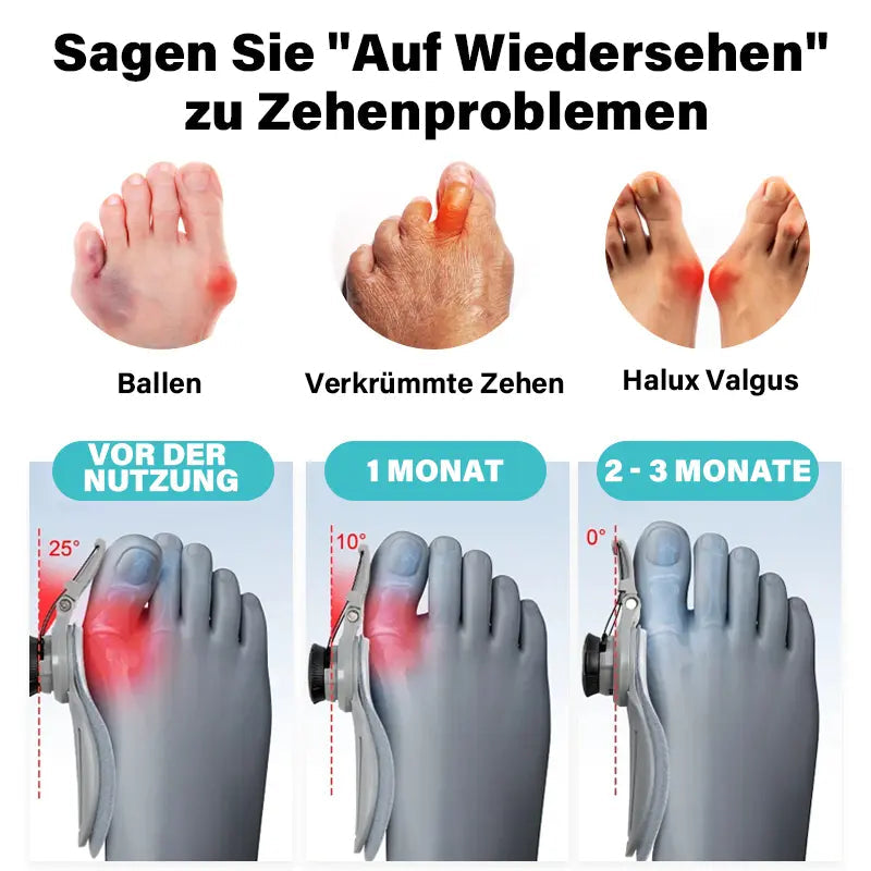 BunionRelief™  Ballenzeh-Korrektur